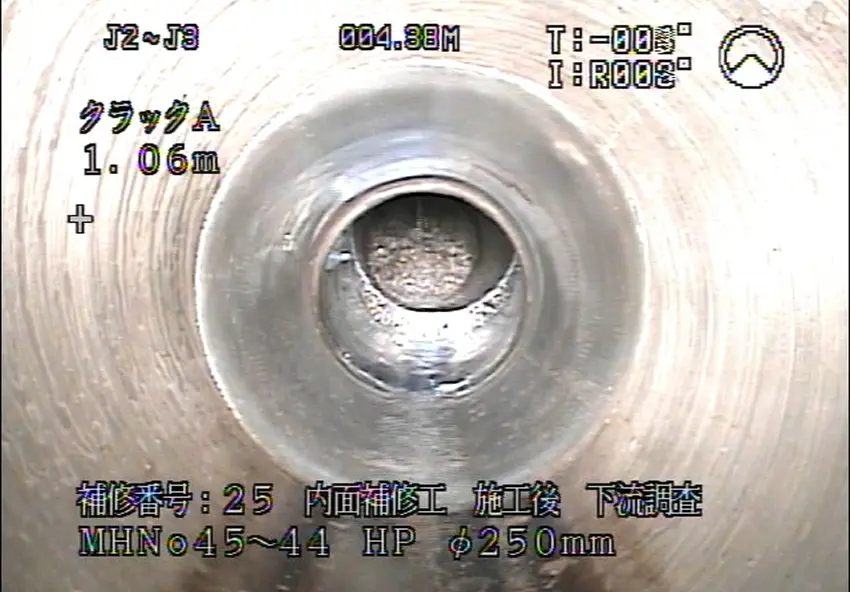 木根除去